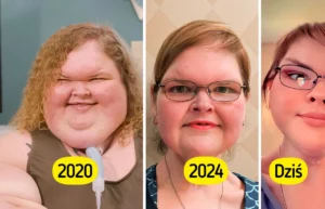 1000-Lb Sisters” Star Debuts After Excess Skin Removal Surgery — Fans Are Amazed