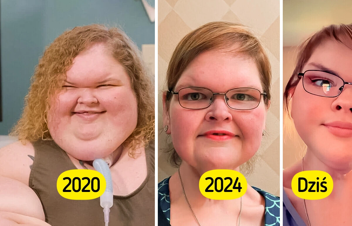 1000-Lb Sisters” Star Debuts After Excess Skin Removal Surgery — Fans Are Amazed